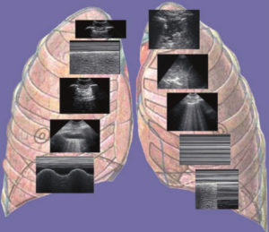 ultrazvuk-pluća-banja-luka